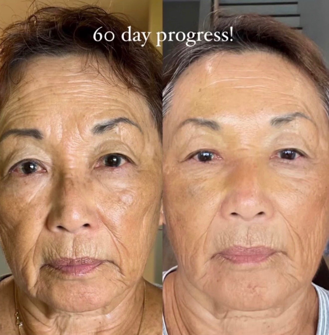 Before and after, 60 days