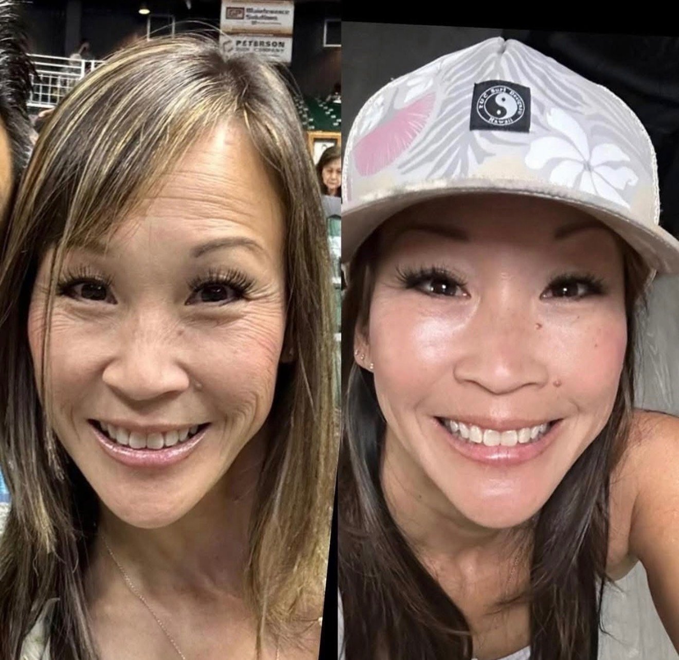 Before and after, brighter and more even-looking skin