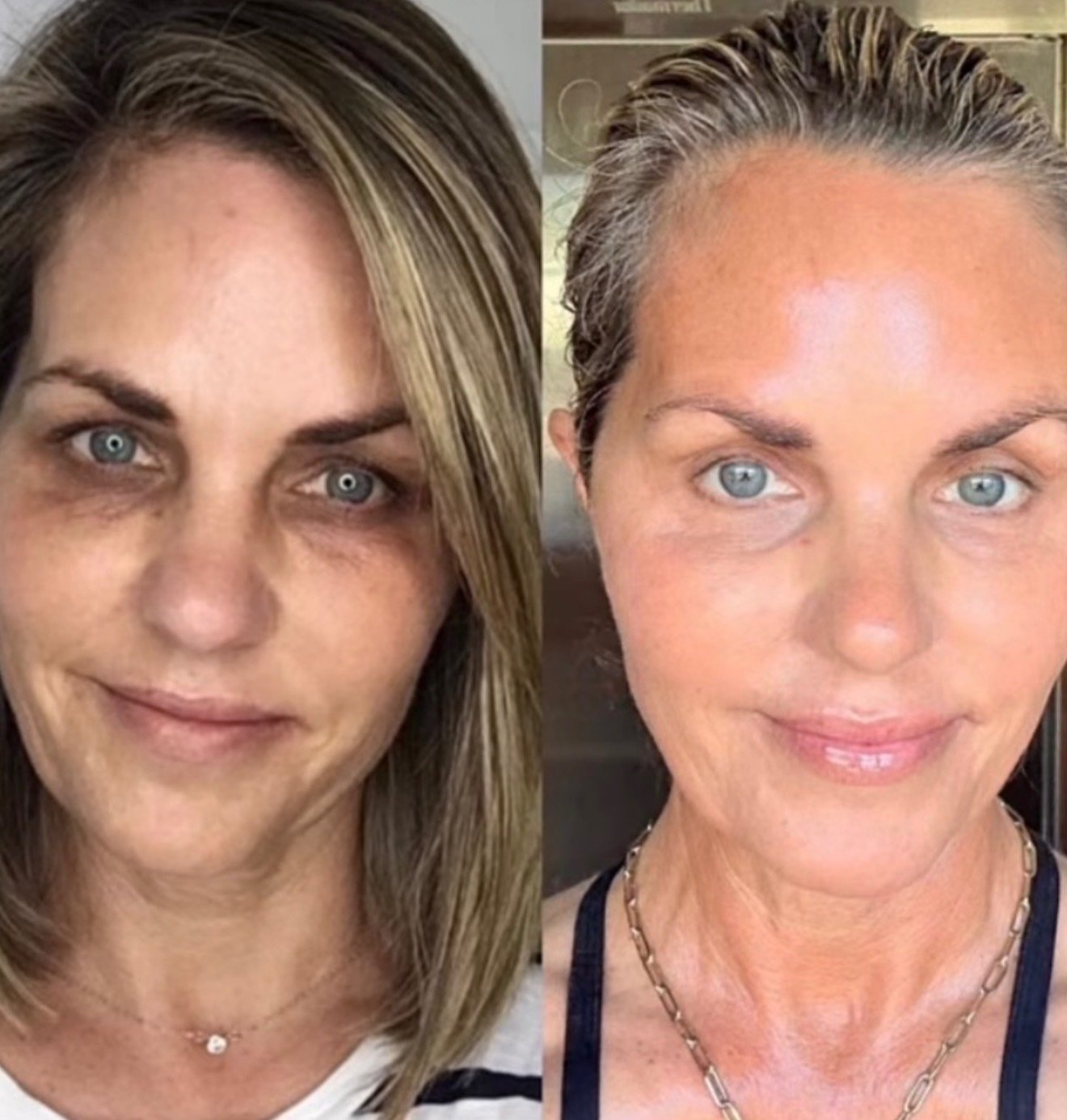 Before and after, more radiant-looking skin