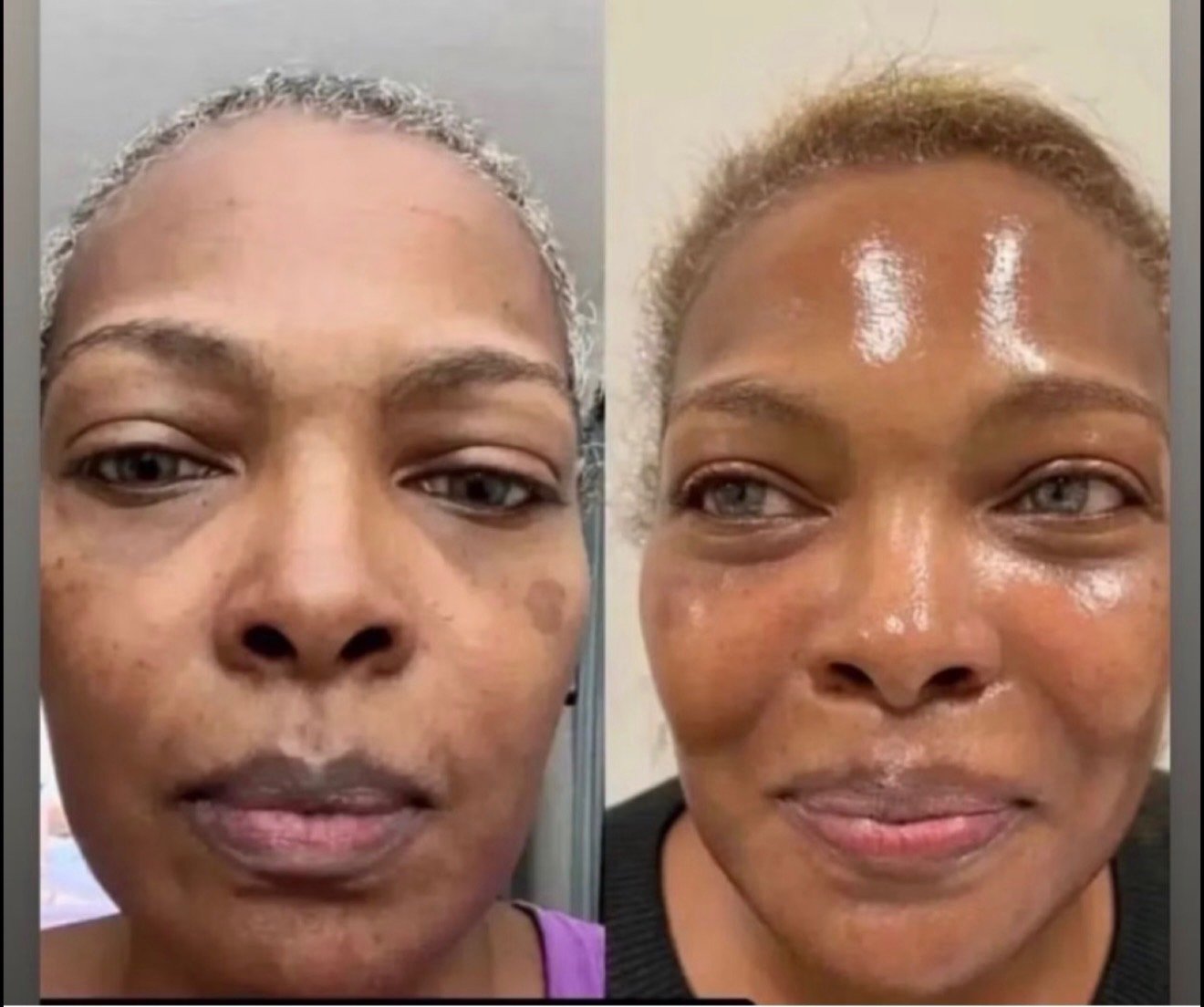 Before and after, a visible glow
